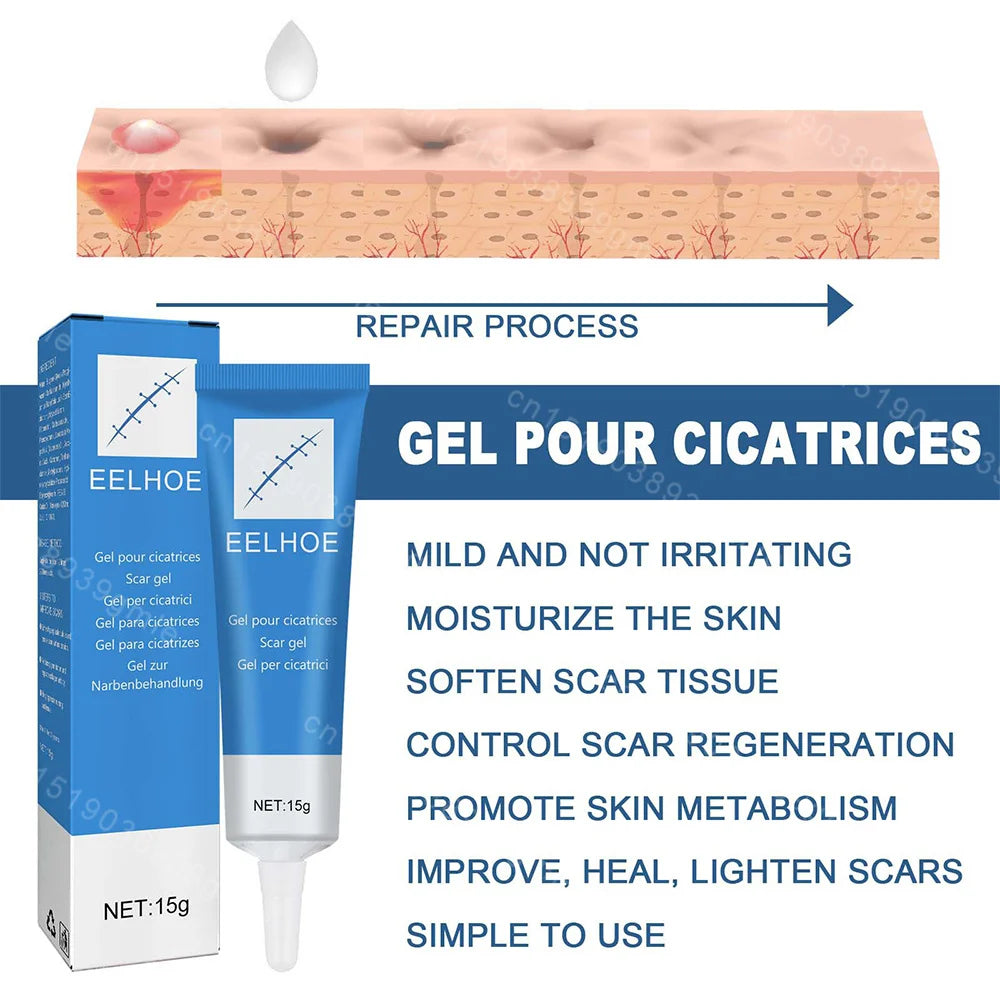 15G Recovery Scar Cream Fast Removal Skin Scars Treat Surgery Scars Stretch Marks Acne Pox Prints Burn Repair Facial Care Gel
