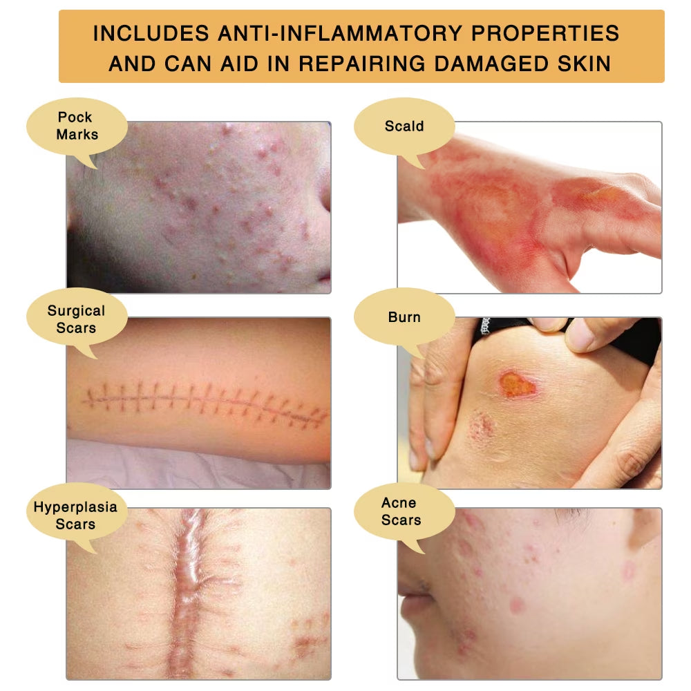 Scar Gel for Scars, Burns, Stretch Marks – with Ginseng & Centella Asiatica, Helps Support Skin Appearance