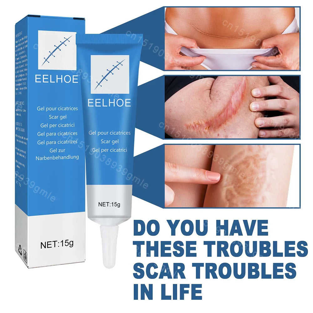 15G Recovery Scar Cream Fast Removal Skin Scars Treat Surgery Scars Stretch Marks Acne Pox Prints Burn Repair Facial Care Gel