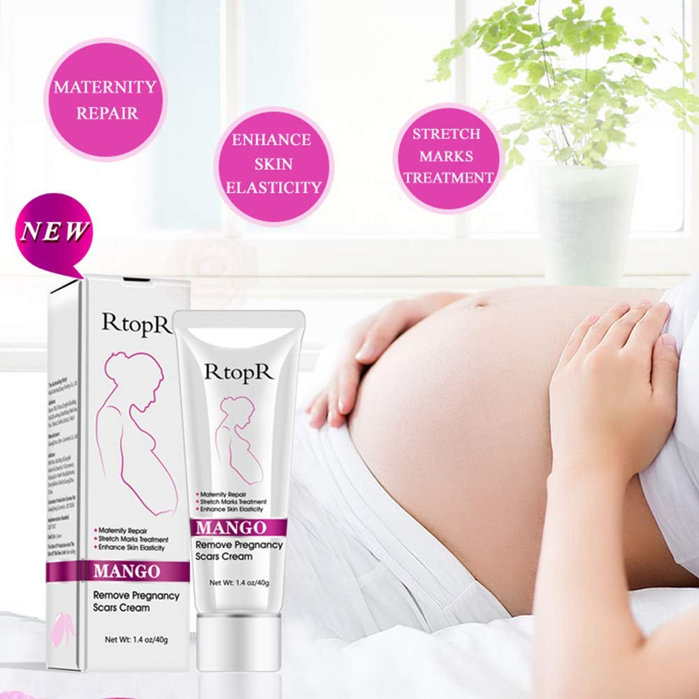 Mango Stretch Marks and Scar Cream, Stretch Mark and Scar Removal Cream for Pregnancy, Belly Creams for Wrinkles, Obesity Fat Marks Scars Moisturizing, Remove Marks (40G)