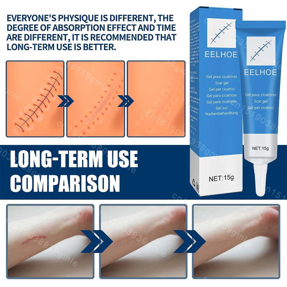 15G Recovery Scar Cream Fast Removal Skin Scars Treat Surgery Scars Stretch Marks Acne Pox Prints Burn Repair Facial Care Gel