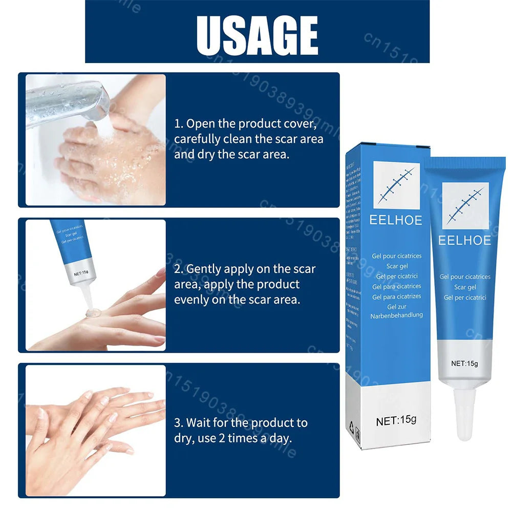 15G Recovery Scar Cream Fast Removal Skin Scars Treat Surgery Scars Stretch Marks Acne Pox Prints Burn Repair Facial Care Gel