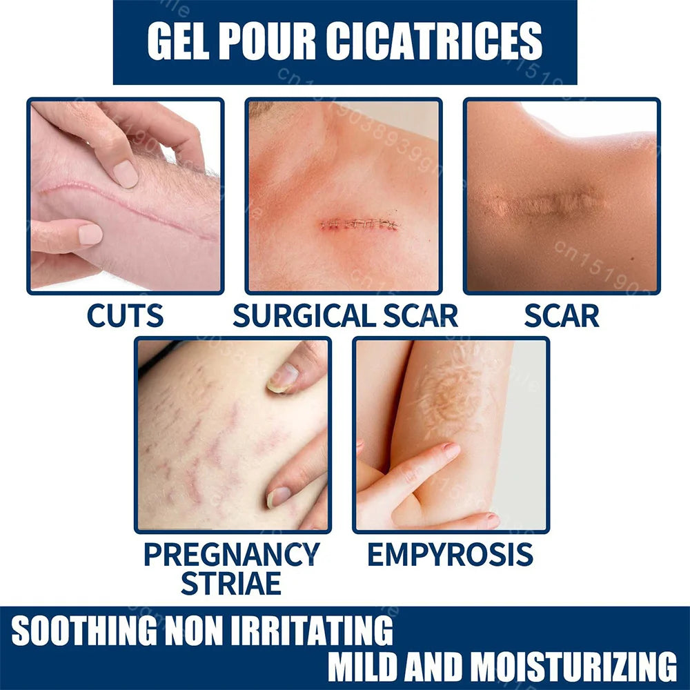 15G Recovery Scar Cream Fast Removal Skin Scars Treat Surgery Scars Stretch Marks Acne Pox Prints Burn Repair Facial Care Gel