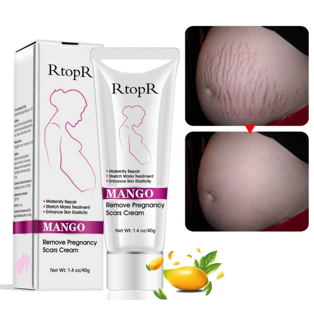 Mango Stretch Marks and Scar Cream, Stretch Mark and Scar Removal Cream for Pregnancy, Belly Creams for Wrinkles, Obesity Fat Marks Scars Moisturizing, Remove Marks (40G)