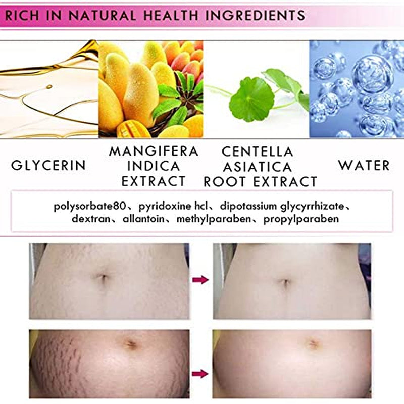 Mango Stretch Marks and Scar Cream, Stretch Mark and Scar Removal Cream for Pregnancy, Belly Creams for Wrinkles, Obesity Fat Marks Scars Moisturizing, Remove Marks (40G)
