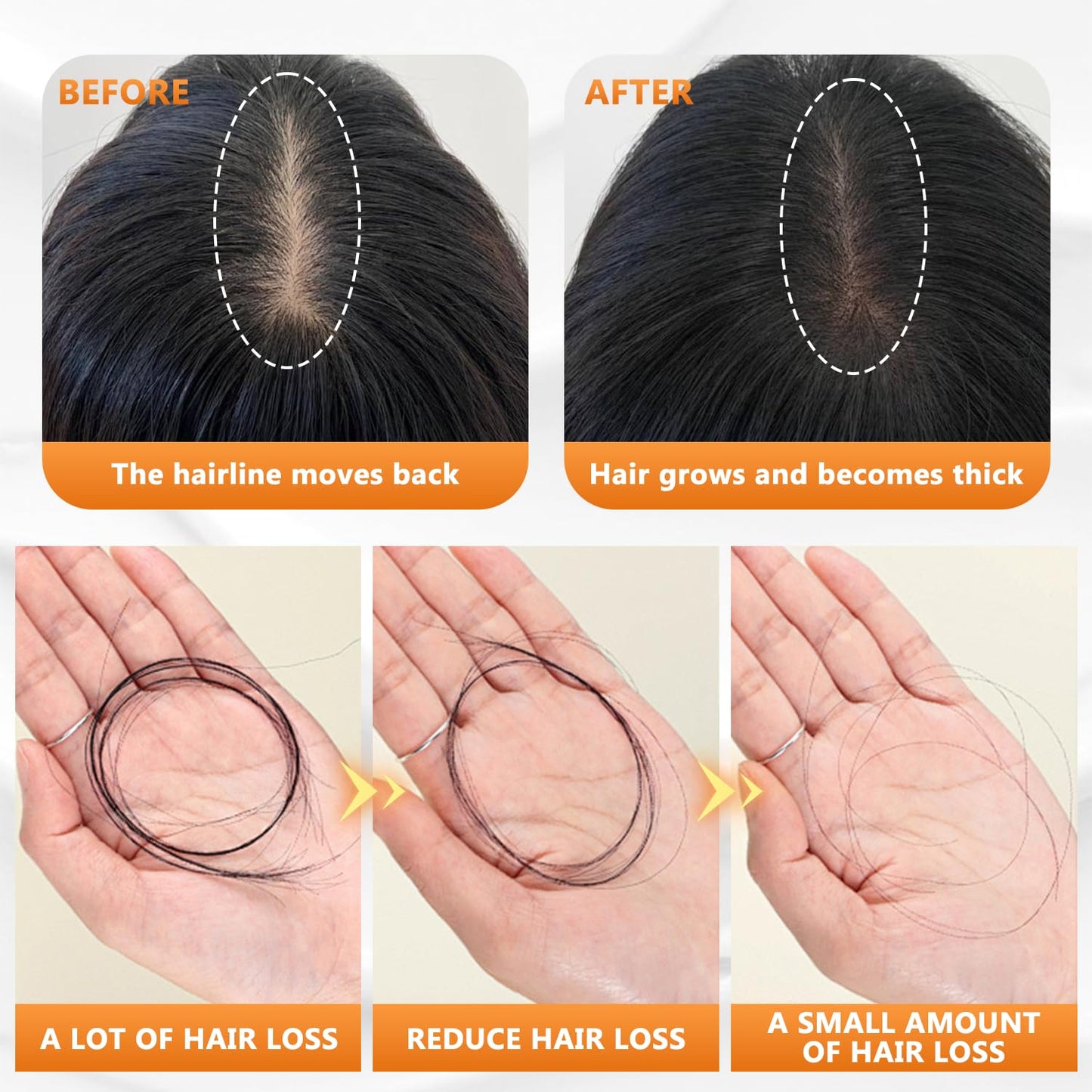Anti-Hair Fall Hair Loss Shampoo for Women, Hair Growth Shampoo Rich in Various Plant Extracts for All Hair Types (100Ml, 3Pcs)